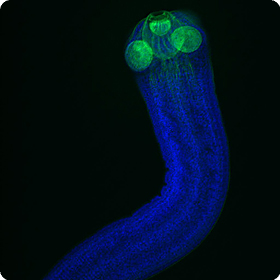 Hymenolepis microstoma