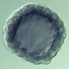 rkhd RNA in situ - Wildtype, click for more info!